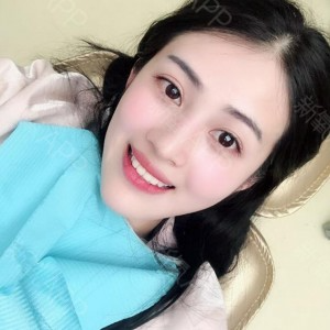 上?？仆呖谇会t(yī)院醫(yī)生鄧建儒做牙齒冷光美白怎么樣？附案例效果對(duì)比圖