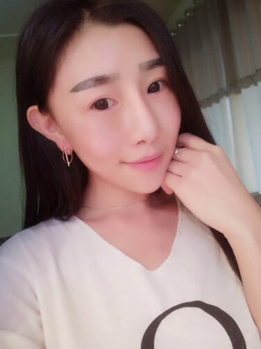 貴陽泰康樂醫(yī)院整形美容科醫(yī)生陳璐做自體脂肪全臉填充效果怎么樣？