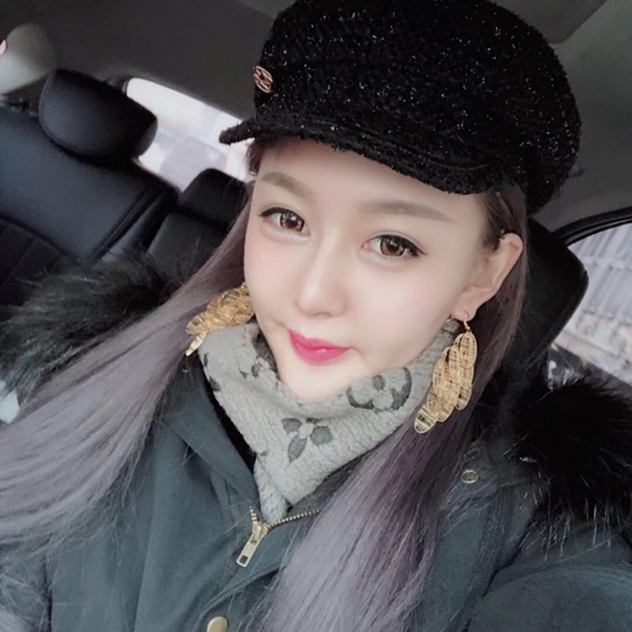 杭州格萊美整形美容醫(yī)院醫(yī)生張霞飛做自體脂肪全臉填充效果怎么樣？