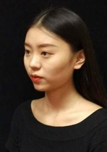 長(zhǎng)沙星雅醫(yī)療美容醫(yī)院醫(yī)生陳煥武做埋線提升怎么樣？