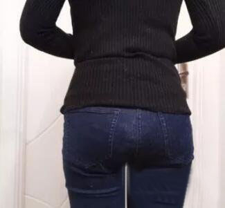 廣州尚美善造美容醫(yī)院醫(yī)生邵方做水動(dòng)力吸脂怎么樣？附案例效果圖