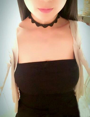 海南伊佳醫(yī)療美容醫(yī)院醫(yī)生涂陽君做假體隆胸怎么樣？附案例效果對比圖