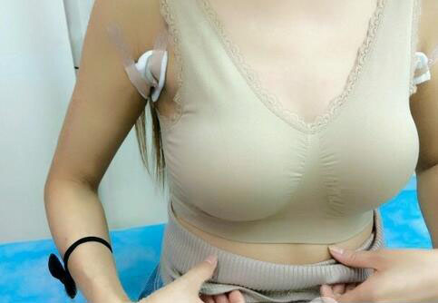 海南伊佳醫(yī)療美容醫(yī)院醫(yī)生涂陽君做假體隆胸怎么樣？附案例效果對比圖