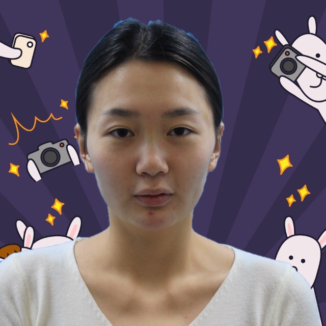 杭州格萊美整形美容醫(yī)院醫(yī)生張霞飛做自體脂肪全臉填充效果怎么樣？