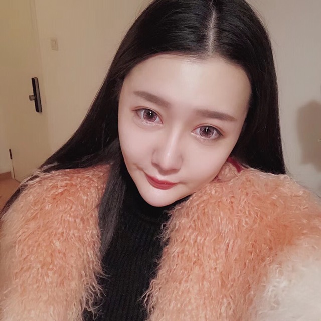 杭州格萊美整形美容醫(yī)院醫(yī)生張霞飛做自體脂肪全臉填充效果怎么樣？