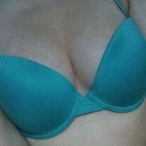 河南協(xié)和醫(yī)院整形外科醫(yī)生騰利做自體脂肪隆胸怎么樣？附案例效果對(duì)比圖