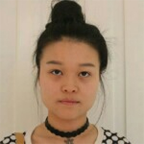 鄭州管城中醫(yī)院整形美容中心醫(yī)生張秀英做注射瘦臉怎么樣？附除皺瘦臉案例效果圖