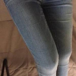 貴陽華美整形美容醫(yī)院醫(yī)生田永華做大腿吸脂效果怎么樣？附大腿吸脂案例前后對比圖