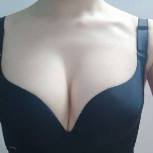 長沙亞韓醫(yī)學(xué)美容醫(yī)院醫(yī)生鄭京湘做假體隆胸怎么樣？附醫(yī)生案例效果對(duì)比圖