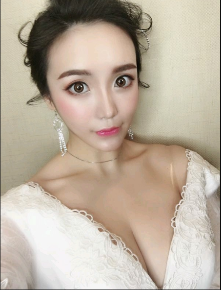 重慶當(dāng)代整形美容醫(yī)院醫(yī)生楊健做假體隆胸怎么樣？附案例