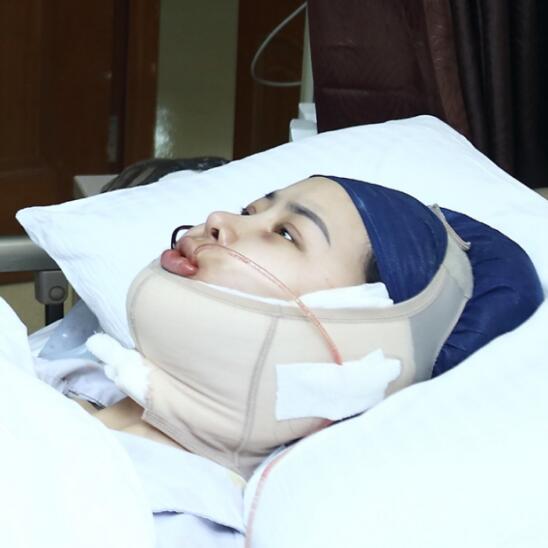 上海時(shí)光整形外科醫(yī)院醫(yī)生李靜林做假體隆鼻和反頜手術(shù)怎么樣？