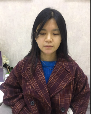 上海時(shí)光整形外科醫(yī)院醫(yī)生何晉龍做假體隆胸怎么樣？附案例效果對(duì)比圖