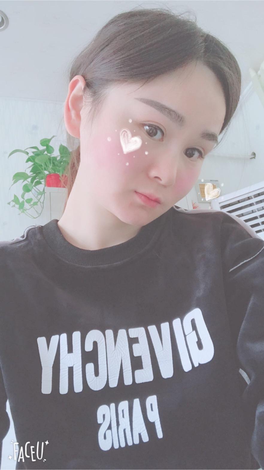 北京彤美美容整形醫(yī)院醫(yī)生楊曉惠做顴骨內(nèi)推+面部吸脂手術(shù)效果怎么樣？附案例