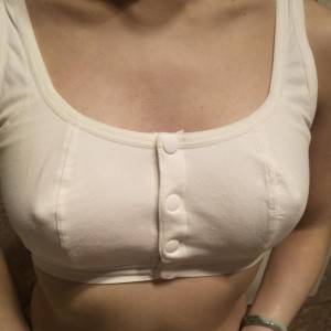 長沙亞韓醫(yī)學(xué)美容醫(yī)院醫(yī)生鄭京湘做假體隆胸怎么樣？附醫(yī)生案例效果對比圖