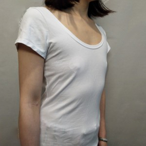 長沙亞韓醫(yī)學(xué)美容醫(yī)院醫(yī)生鄭京湘做假體隆胸怎么樣？附醫(yī)生案例效果對比圖