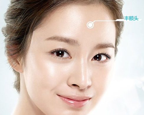 三亞圣迪亞整形美容醫(yī)院假體豐額頭