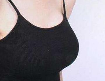 福州新時(shí)代醫(yī)療美容門診部乳房下垂矯正