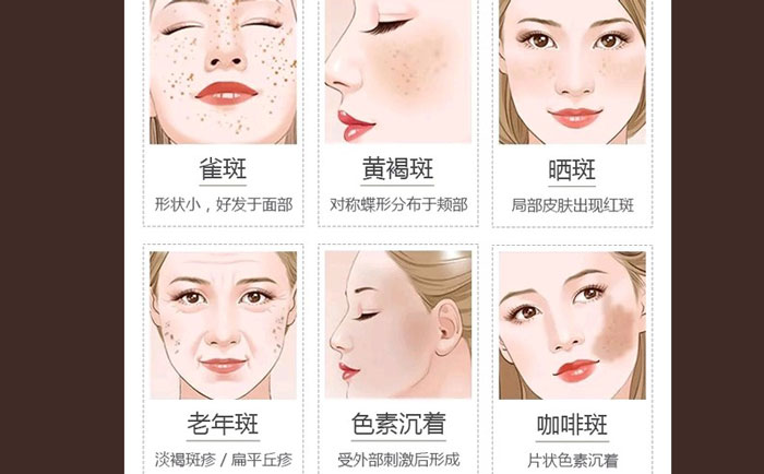 醫(yī)院激光祛斑貴不貴？正規(guī)醫(yī)院激光祛斑多少錢？