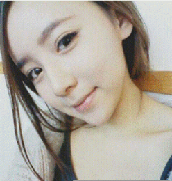 上海時(shí)光整形醫(yī)生何晉龍做假體隆鼻效果怎么樣？附案例效果對(duì)比圖