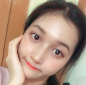 上海時(shí)光整形醫(yī)院做面部玻尿酸注射效果怎么樣？