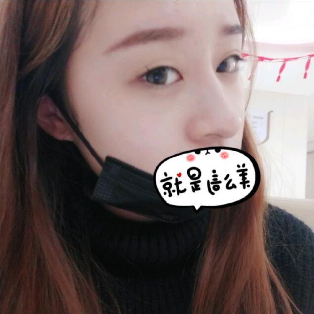 上海時光整形做玻尿酸注射隆鼻效果怎么樣？附陳文慧醫(yī)生真實案例對比圖