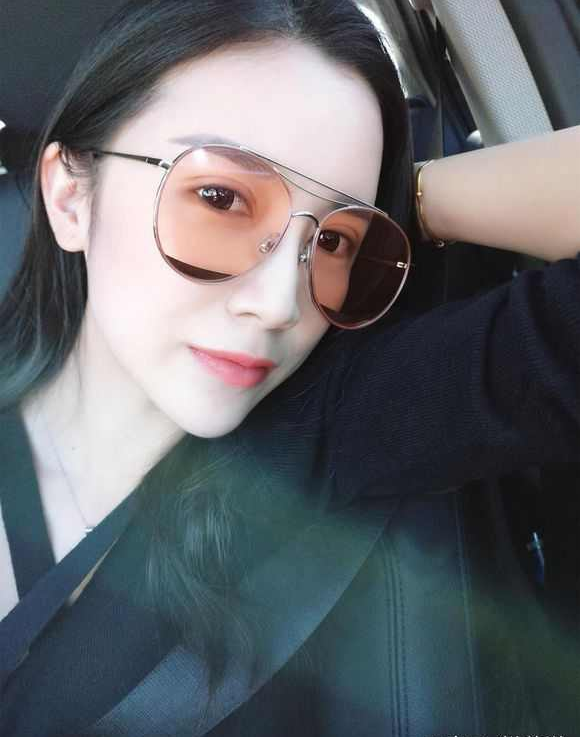 上海時光整形醫(yī)院張晶醫(yī)生做開眼角怎么樣？附真實效果圖