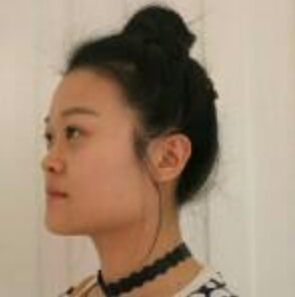 上海時光整形醫(yī)院左雯君醫(yī)生注射瘦臉針效果怎么樣？附真實案例圖