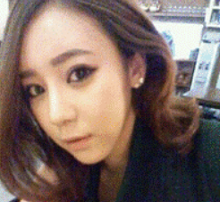 上海時(shí)光整形醫(yī)生何晉龍做假體隆鼻效果怎么樣？附案例效果對比圖