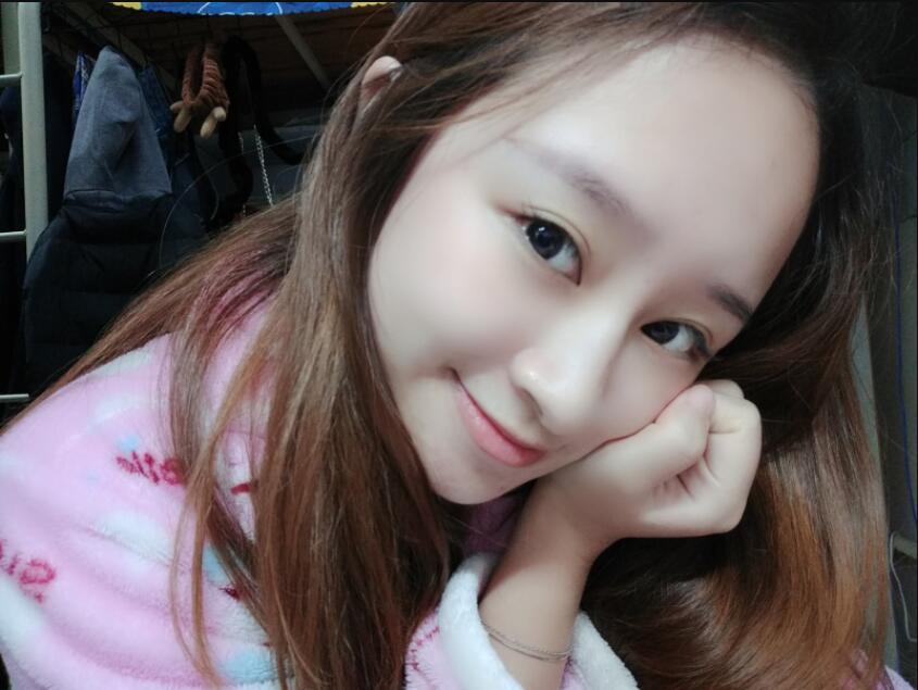 上海時光整形做玻尿酸注射隆鼻效果怎么樣？附陳文慧醫(yī)生真實案例對比圖