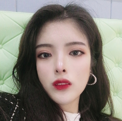 合肥韓美整形醫(yī)院做雙眼皮+開(kāi)眼角效果怎么樣?附石顯武醫(yī)生真實(shí)案例效果圖 合肥韓美整形醫(yī)院做雙眼皮+開(kāi)眼角效果怎么樣?附石顯武醫(yī)生真實(shí)案例效果圖