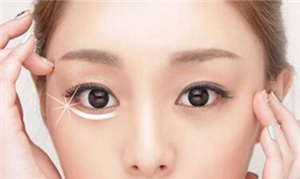 東莞華美醫(yī)療美容醫(yī)院激光祛眼袋