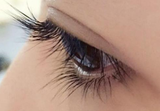 海南華美醫(yī)學美容醫(yī)院雙眼皮