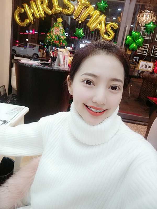 巴中華醫(yī)口腔醫(yī)院做牙齒矯正效果好嗎？附母汶靈醫(yī)生牙齒矯正案例效果圖