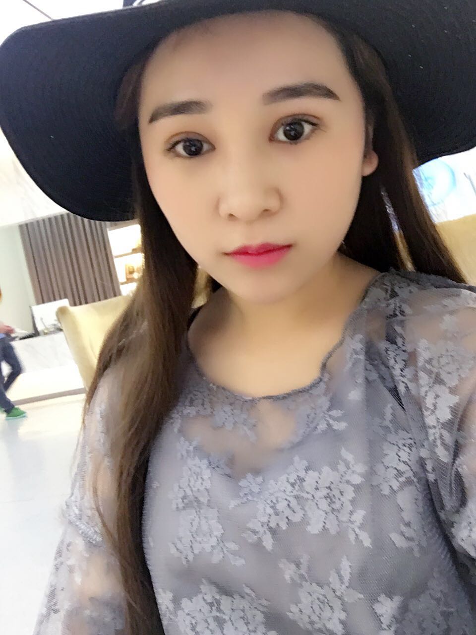 蚌埠韓美美萊整形醫(yī)生鄭捷做開眼角怎么樣？附案例效果圖