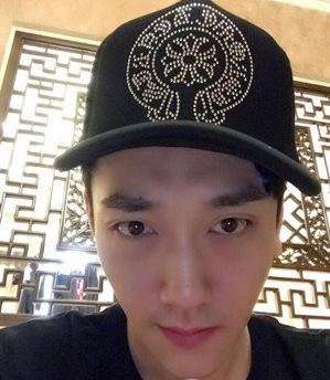 鞍山燕麗醫(yī)療美容醫(yī)院薛媚醫(yī)生做去眼袋效果怎么樣？附案例效果對比圖