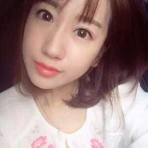 蚌埠韓美美萊整形做玻尿酸面部除皺效果怎么樣？附陳澤醫(yī)生案例效果圖