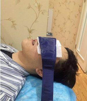 鞍山燕麗醫(yī)療美容醫(yī)院薛媚醫(yī)生做去眼袋效果怎么樣？附案例效果對比圖