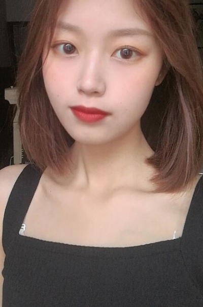 安陽市人民醫(yī)院燒傷整形中心做手術(shù)激光祛斑效果怎么樣？附案例效果對比圖