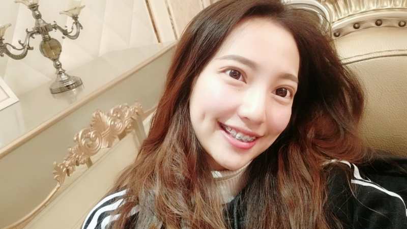 巴中華醫(yī)口腔醫(yī)院做牙齒矯正效果好嗎？附母汶靈醫(yī)生牙齒矯正案例效果圖