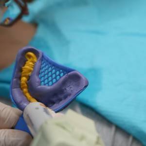 鞍山時(shí)代口腔門診部做瓷貼面案例效果圖 鞍山時(shí)代口腔門診部做瓷貼面案例效果圖