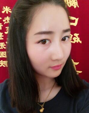 鞍山菲之都整形醫(yī)生李宗亮做字體脂肪豐太陽(yáng)穴效果怎么樣？附案例效果對(duì)比圖