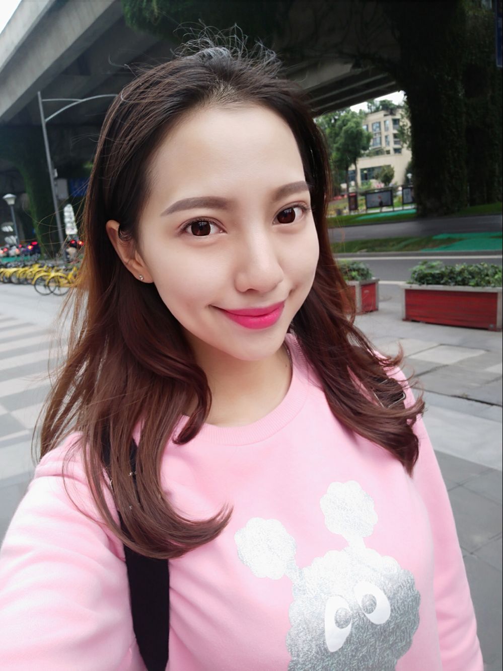 巴中華醫(yī)口腔醫(yī)院做牙齒矯正效果好嗎？附母汶靈醫(yī)生牙齒矯正案例效果圖