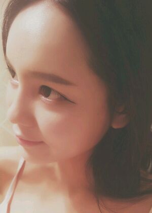 鞍山王景醫(yī)療美容外科診所做自體脂肪豐蘋(píng)果肌效果怎么樣？附張婉鸝案例效果圖