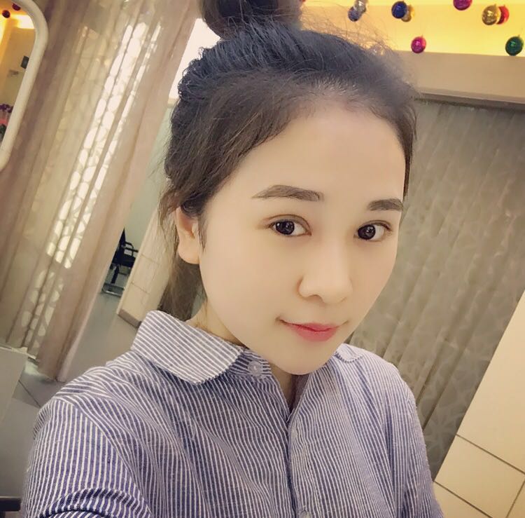 蚌埠韓美美萊整形醫(yī)生鄭捷做開眼角怎么樣？附案例效果圖