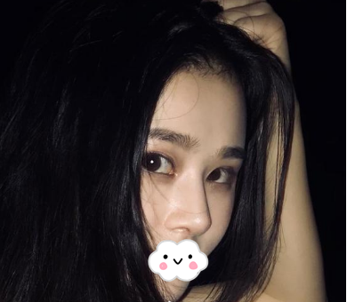 蚌埠韓美美萊整形醫(yī)生歷芳做耳軟骨隆鼻怎么樣？附耳軟骨隆鼻案例對(duì)比圖