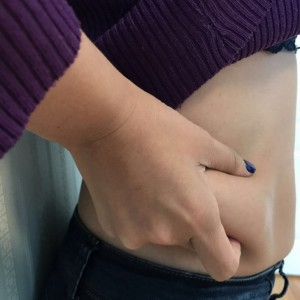 蚌埠韓美美萊整形醫(yī)生張濤做水動(dòng)力吸脂怎么樣？附吸脂案例效果圖