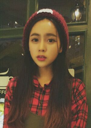 鞍山王景醫(yī)療美容外科診所做自體脂肪豐蘋(píng)果肌效果怎么樣？附張婉鸝案例效果圖