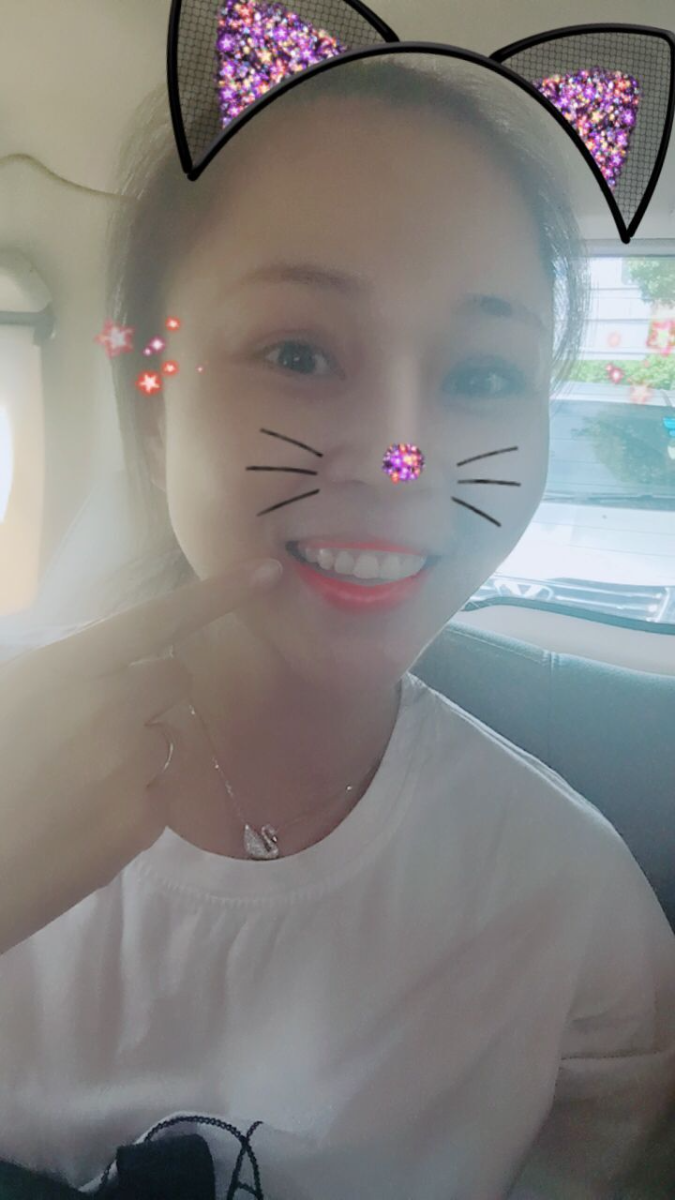 保定東陽(yáng)口腔醫(yī)院趙星醫(yī)生做牙齒瓷貼面怎么樣？附牙齒瓷貼面案例效果對(duì)比圖