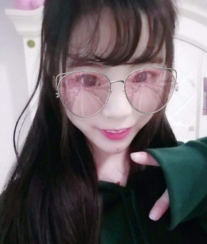 保定市第五醫(yī)院美容整形科做玻尿酸墊下巴怎么樣？附楊瑞萍醫(yī)生案例效果圖