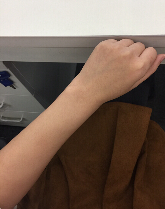 蚌埠市第三人民醫(yī)院燒傷整形科李方奇注射美白針效果怎么樣？安全嗎？附案例